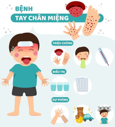 TRƯỜNG TIỂU HỌC NGÔ QUYỀN TĂNG CƯỜNG TUYÊN TRUYỀN PHÒNG, CHỐNG BỆNH TAY CHÂN MIỆNG Ở HỌC SINH