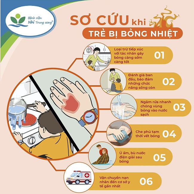 KỸ NĂNG SƠ CỨU BỎNG NHIỆT CHO HỌC SINH TIỂU HỌC VÀ CÁC BIỆN PHÁP XỬ TRÍ ĐÚNG CÁCH